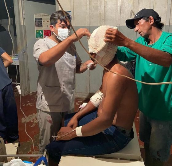 da Operação